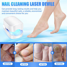 Rechargeable Nail Fungus Laser – Anti-Fungal Device for Toenails, Hands & Feet (Home Use) the24kgal
