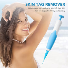 Skin Tag Remover Kit 2 in 1 for Micro to Large (2 mm - 8 mm / 1 Set) the24kgal
