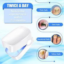 Rechargeable Nail Fungus Laser – Anti-Fungal Device for Toenails, Hands & Feet (Home Use) the24kgal