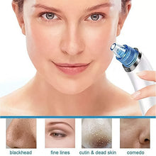 2 in 1 Blackhead Whitehead Extractor Remover Device (Multi-Color / 1 Set / batteries not included) the24kgal