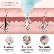 Mini Handheld Vacuum Blackhead Remover – Facial Massage & Spot Lifting (1 Pc) the24kgal